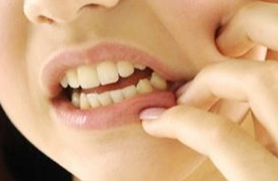 突發(fā)性、自發(fā)性的劇烈牙疼