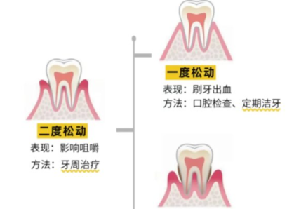 老年人牙齒松動了要怎么辦？