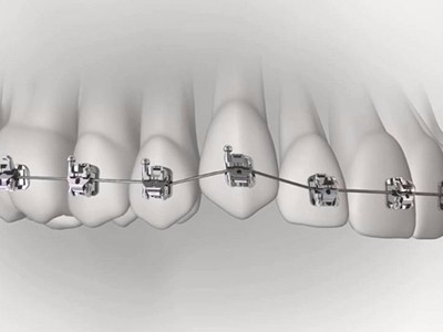 承德市哪家口腔醫(yī)院口腔正畸做得好？惟德口腔醫(yī)院來告訴您