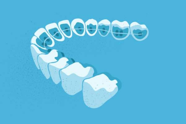 惟德口腔醫(yī)院口腔正畸好不好？